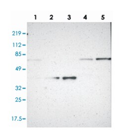 NCF2, Rabbit, Polyclonal Antibody, Abnova 100&mu;L; Unlabeled:Antibodies,
