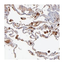 C1QA, Rabbit, Polyclonal Antibody, Abnova 100 &mu;L | Buy Online | Abnova Corporation | Fisher Scientific