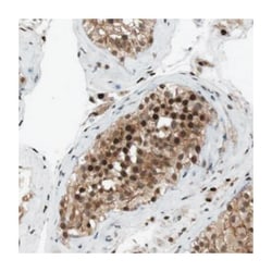 ORAI3 Rabbit, Polyclonal Antibody, Abnova 100 &mu;L | Buy Online | Abnova Corporation | Fisher Scientific