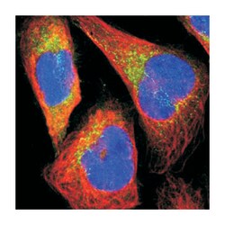 GART, Rabbit, Polyclonal Antibody, Abnova 100&mu;L; Unlabeled:Antibodies,