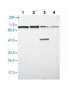 FAM62B, Rabbit, Polyclonal Antibody, Abnova 100 &mu;L | Buy Online | Abnova Corporation | Fisher Scientific