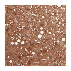 ALDOB, Rabbit, Polyclonal Antibody, Abnova 100&mu;L; Unlabeled:Antibodies,