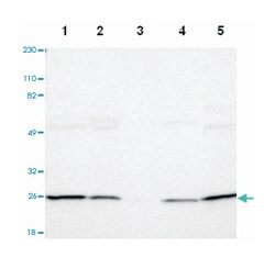 PSMD10 Rabbit anti-Human, Mouse, Rat, Polyclonal Antibody, Abnova 100&mu;L;