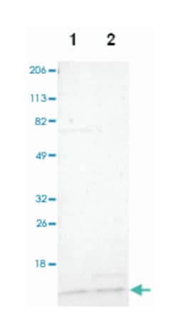 TIMM9, Rabbit, Polyclonal Antibody, Abnova 100 &mu;L | Buy Online | Abnova Corporation | Fisher Scientific