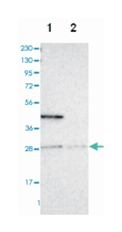 ASB9 Rabbit anti-Human, Polyclonal Antibody, Abnova 100 &mu;L | Buy Online | Abnova Corporation | Fisher Scientific