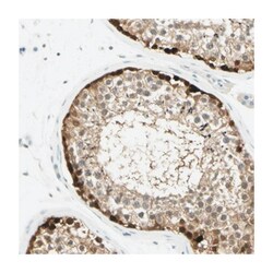 ASB9 Rabbit anti-Human, Polyclonal Antibody, Abnova 100 &mu;L | Buy Online | Abnova Corporation | Fisher Scientific