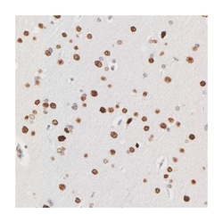 ZFP92, Rabbit, Polyclonal Antibody, Abnova 100 &mu;L | Buy Online | Abnova Corporation | Fisher Scientific