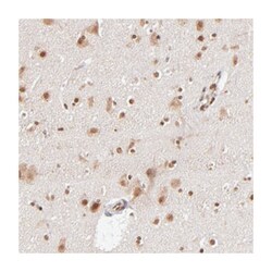 ABL2 Rabbit anti-Human, Polyclonal Antibody, Abnova 100 &mu;L | Buy Online | Abnova Corporation | Fisher Scientific