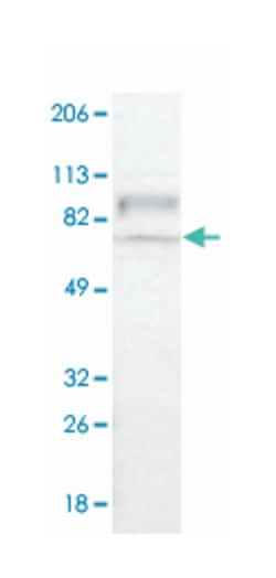 RAP1GAP, Rabbit, Polyclonal Antibody, Abnova 100 &mu;L | Buy Online | Abnova Corporation | Fisher Scientific