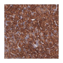 USP51, Rabbit, Polyclonal Antibody, Abnova 100 &mu;L | Buy Online | Abnova Corporation | Fisher Scientific