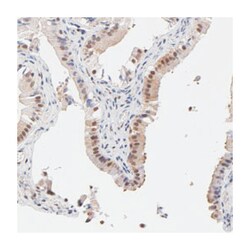 PSMC4, Rabbit, Polyclonal Antibody, Abnova 100&mu;L; Unlabeled:Antibodies,
