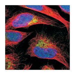 GCET2, Rabbit, Polyclonal Antibody, Abnova 100 &mu;L | Buy Online | Abnova Corporation | Fisher Scientific
