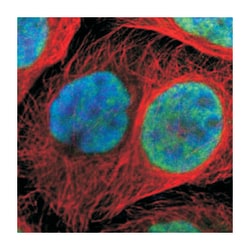 ZNF544, Rabbit, Polyclonal Antibody, Abnova 100&mu;L; Unlabeled:Antibodies,