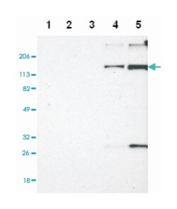 EMILIN1, Rabbit, Polyclonal Antibody, Abnova 100&mu;L; Unlabeled:Antibodies,