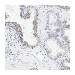 FBXO10, Rabbit, Polyclonal Antibody, Abnova 100&mu;L; Unlabeled:Antibodies,