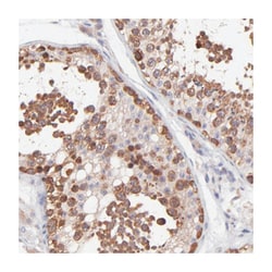 NSF Rabbit anti-Human, Polyclonal Antibody, Abnova 100&mu;L; Unlabeled:Antibodies,