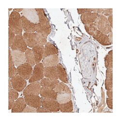 GTPBP1, Rabbit, Polyclonal Antibody, Abnova 100 &mu;L | Buy Online | Abnova Corporation | Fisher Scientific
