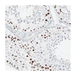 SAGE1 Rabbit anti-Human, Polyclonal Antibody, Abnova 100 &mu;L | Buy Online | Abnova | Fisher Scientific