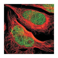 SAGE1 Rabbit anti-Human, Polyclonal Antibody, Abnova 100 &mu;L | Buy Online | Abnova | Fisher Scientific