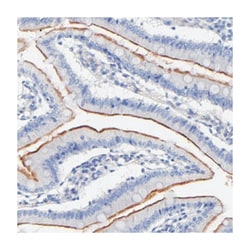 SLC44A2 Rabbit anti-Human, Polyclonal Antibody, Abnova 100 &mu;L | Buy Online | Abnova Corporation | Fisher Scientific