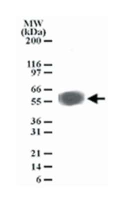 PLXDC1, Mouse, Clone: 197C193 (IM193), Abnova 100&mu;g; Unlabeled:Antibodies,