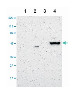 ZNF670, Rabbit, Polyclonal Antibody, Abnova 100&mu;L; Unlabeled:Antibodies,