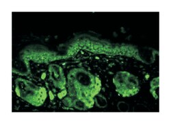 Sod2, Rabbit, Polyclonal Antibody, Abnova 100&mu;g; Unlabeled:Antibodies,