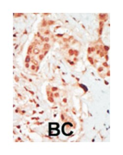 PFTK2, Rabbit, Polyclonal Antibody, Abnova 400 &mu;L | Buy Online | Abnova | Fisher Scientific