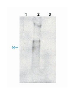 SPP1 (Osteopontin-c), Chicken, Polyclonal Antibody, Abnova 100&mu;g; Unlabeled:Anticuerpos