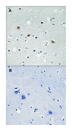 LATS1/LATS2 (phospho T1079/1041), Rabbit anti-Human, Mouse, Polyclonal