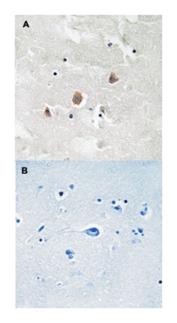 MAP3K1 (phospho T1400), Rabbit anti-Human, Mouse, Rat, Polyclonal Antibody,