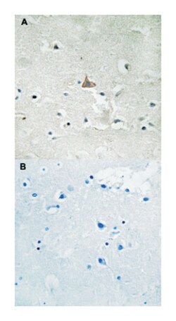 NTRK2 (phospho Y706/Y707), Rabbit anti-Human, Mouse, Rat, Polyclonal Antibody,