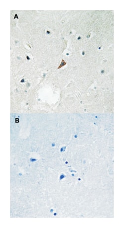 PTK2B (phospho Y579), Rabbit anti-Human, Mouse, Rat, Polyclonal Antibody, Abnova 100 &mu;L | Buy Online | Abnova | Fisher Scientific
