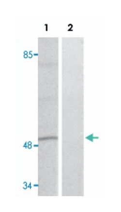 DPYSL2 (phospho T509), Rabbit anti-Human, Mouse, Rat, Polyclonal Antibody, Abnova 100 &mu;L | Buy Online | Abnova | Fisher Scientific