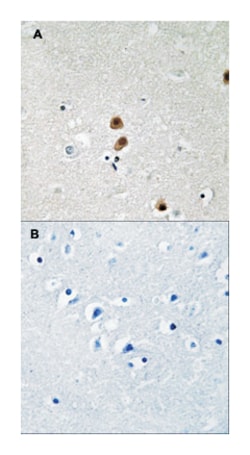 CTBP1, Rabbit, Polyclonal Antibody, Abnova 100 &mu;L | Buy Online | Abnova Corporation | Fisher Scientific