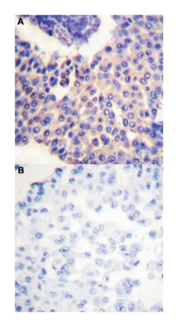 ARRB1 (phospho S412), Rabbit anti-Human, Mouse, Polyclonal Antibody, Abnova 100 &mu;L | Buy Online | Abnova | Fisher Scientific