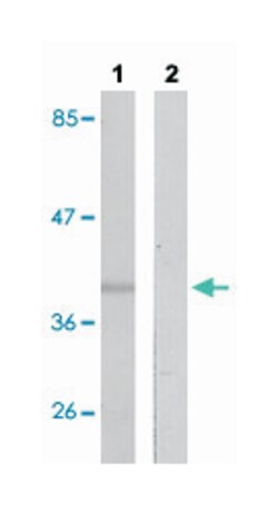 PRKACA/PRKACB, Rabbit, Polyclonal Antibody, Abnova 100&mu;L; Unlabeled:Antibodies,