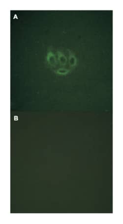 TNK2 (phospho Y284), Rabbit anti-Human, Polyclonal Antibody, Abnova 100&mu;L;