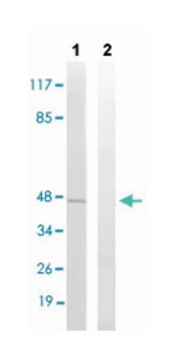 CHEK1 (phospho S296), Rabbit anti-Human, Mouse, Rat, Polyclonal Antibody, Abnova 100 &mu;L | Buy Online | Abnova Corporation | Fisher Scientific