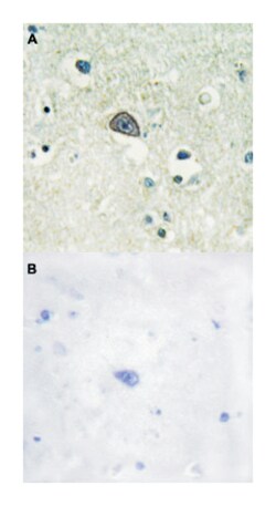 GRIN1 (phospho S890), Rabbit anti-Human, Mouse, Rat, Polyclonal Antibody,