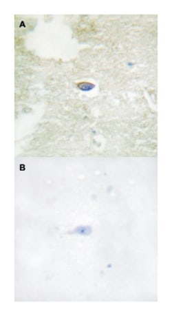 TGFBR2 (phospho S225/S250), Rabbit anti-Human, Polyclonal Antibody, Abnova