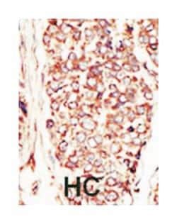 ERBB2 Rabbit anti-Human, Polyclonal Antibody, Abnova 400 &mu;L | Buy Online | Abnova Corporation | Fisher Scientific