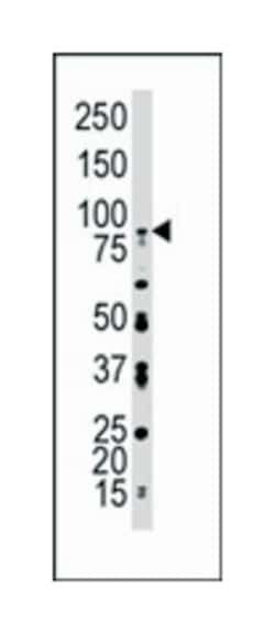 FGFR4, Rabbit, Polyclonal Antibody, Abnova 400 &mu;L | Buy Online | Abnova Corporation | Fisher Scientific
