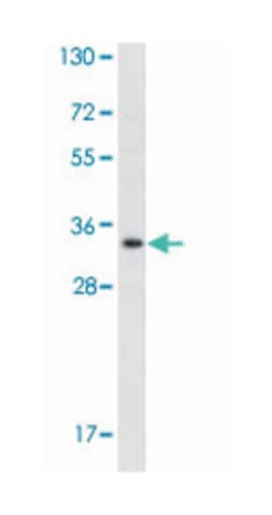 DPPA4 Rabbit anti-Human, Polyclonal Antibody, Abnova 400 &mu;L | Buy Online | Abnova Corporation | Fisher Scientific