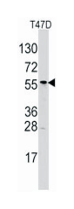 ALDH6A1 Rabbit anti-Human, Polyclonal Antibody, Abnova 400&mu;L; Unlabeled:Antibodies,