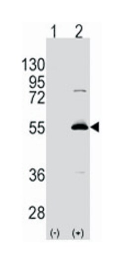 ALDH6A1 Rabbit anti-Human, Polyclonal Antibody, Abnova 400 &mu;L | Buy Online | Abnova Corporation | Fisher Scientific