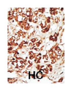 ZAK (MLKLAK), Rabbit, Polyclonal Antibody, Abnova 400&mu;L; Unlabeled:Antibodies,