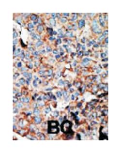 NME2, Rabbit, Polyclonal Antibody, Abnova 400&mu;L; Unlabeled:Antibodies,