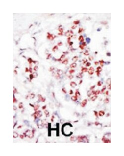 TLK1 Rabbit anti-Human, Polyclonal Antibody, Abnova 400&mu;L; Unlabeled:Antibodies,