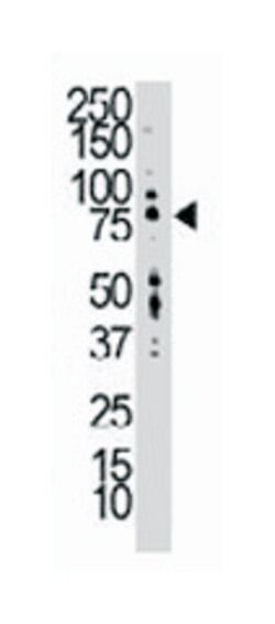 LTK, Rabbit, Polyclonal Antibody, Abnova 400 &mu;L | Buy Online | Abnova Corporation | Fisher Scientific